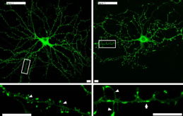 Synapses Photo