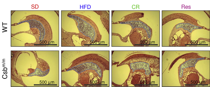 A HFD Increases b-OHB Levels and Rescues the Neurological Phenotype of Csbm/m Mice.   Representative histological images of hematoxylin-and-eosin-stained sections of the inner ear (blue highlight: spiral ganglion).  A High-Fat Diet and NAD+ Activate Sirt1 to Rescue Premature Aging in Cockayne Syndrome.  Bohr et al 2014.