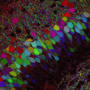 More than 100 years ago, Golgi staining on nerve cells opened the gates to modern neuroscience. Scientists recently developed the Technicolor version of Golgi staining, Brainbow, allowing more detailed reconstructions of brain circuits.