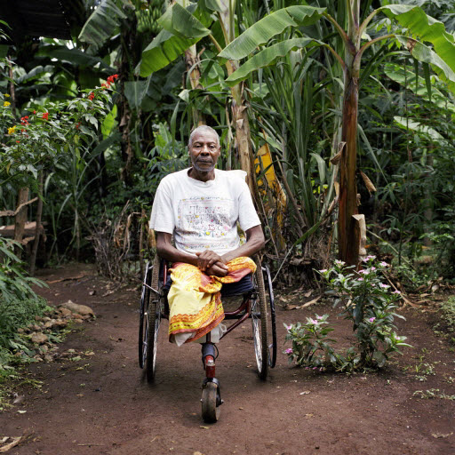 Disability and amputation in Tanzania